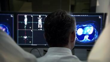 Wissenschaftler sitzen vor den Bildern einer PET-CT AUfnahme