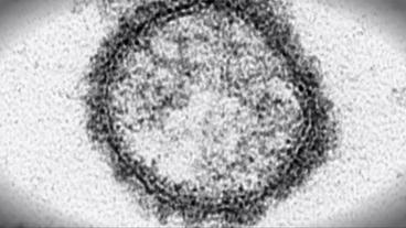 Das Schmallenberg-Virus