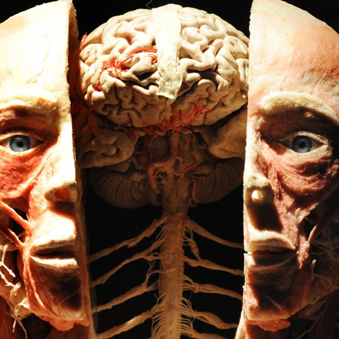 Präparat eines menschlichen Gehirns von Gunter von Hagens 